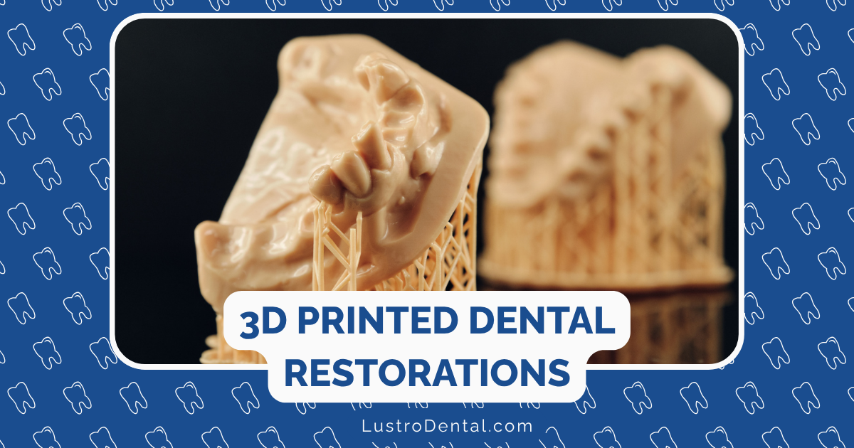3D printed dental restoration