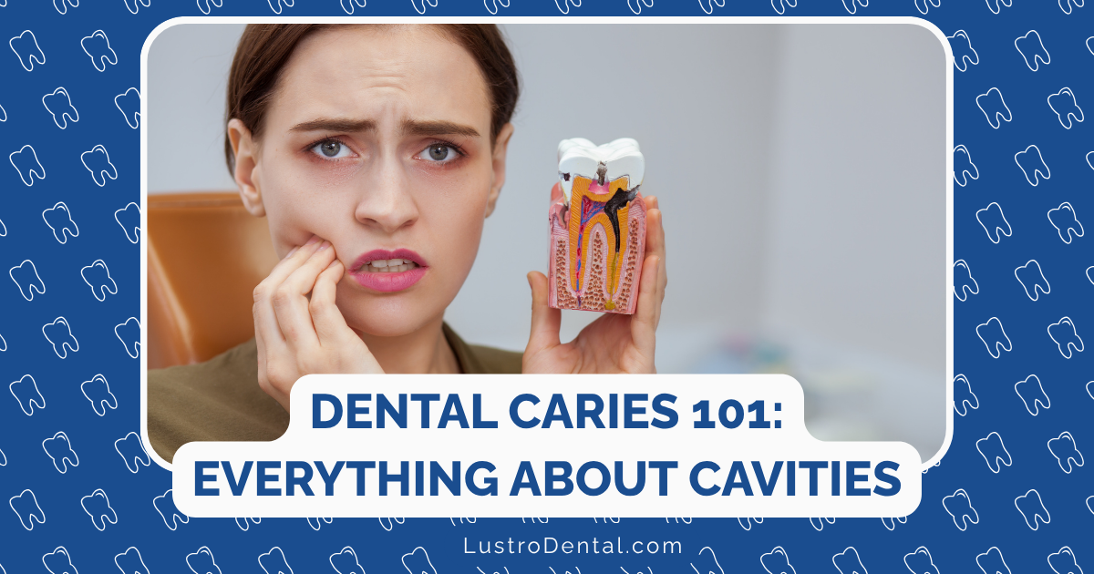 Dental Caries 101