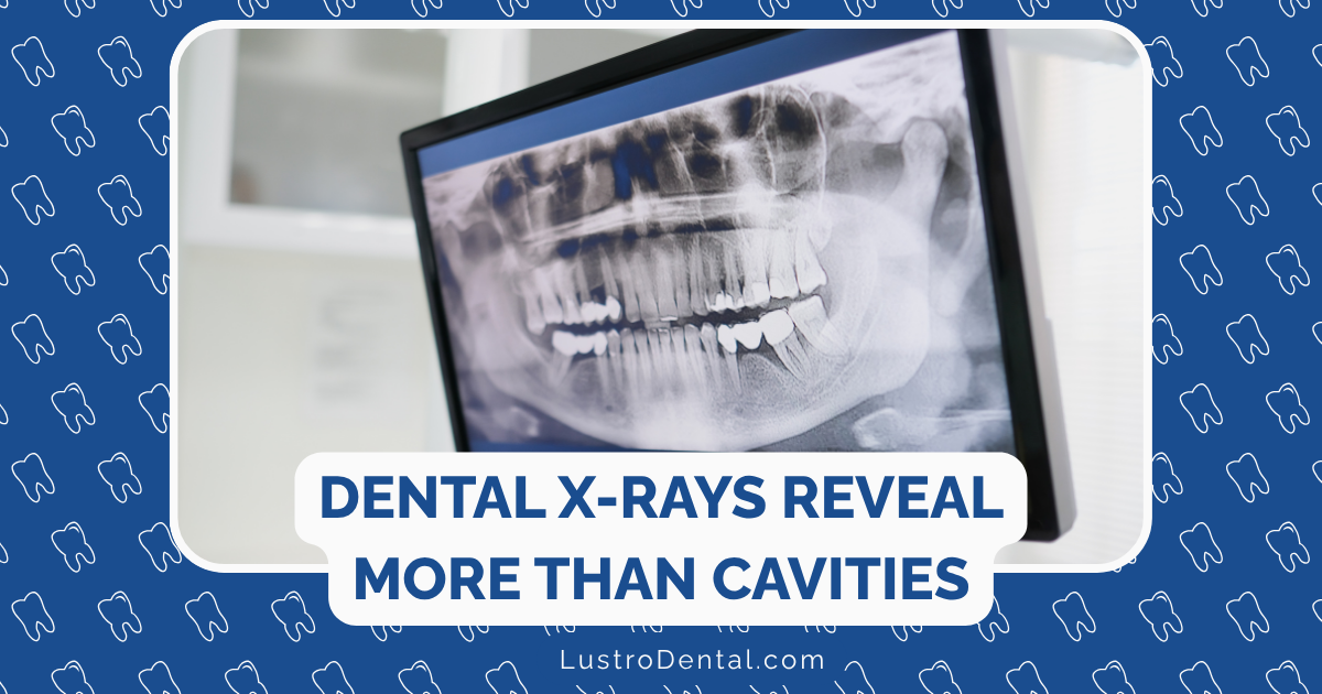 Dental X-Rays Reveal More Than Cavities