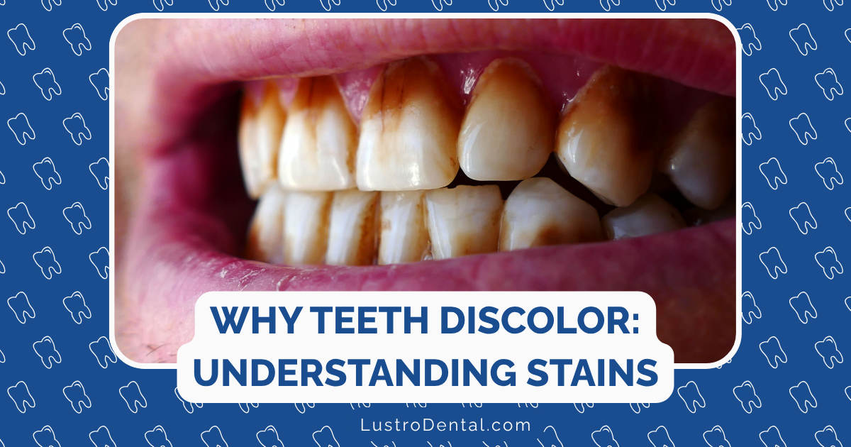 tooth discoloration
