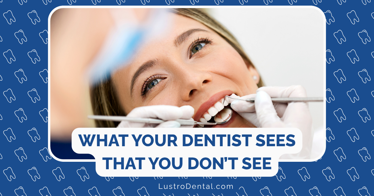 What Happens in a Dental Exam