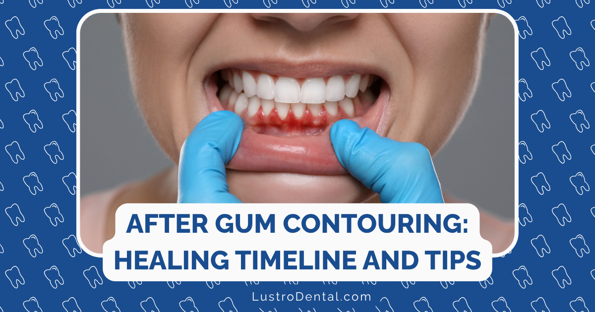 after gum contouring