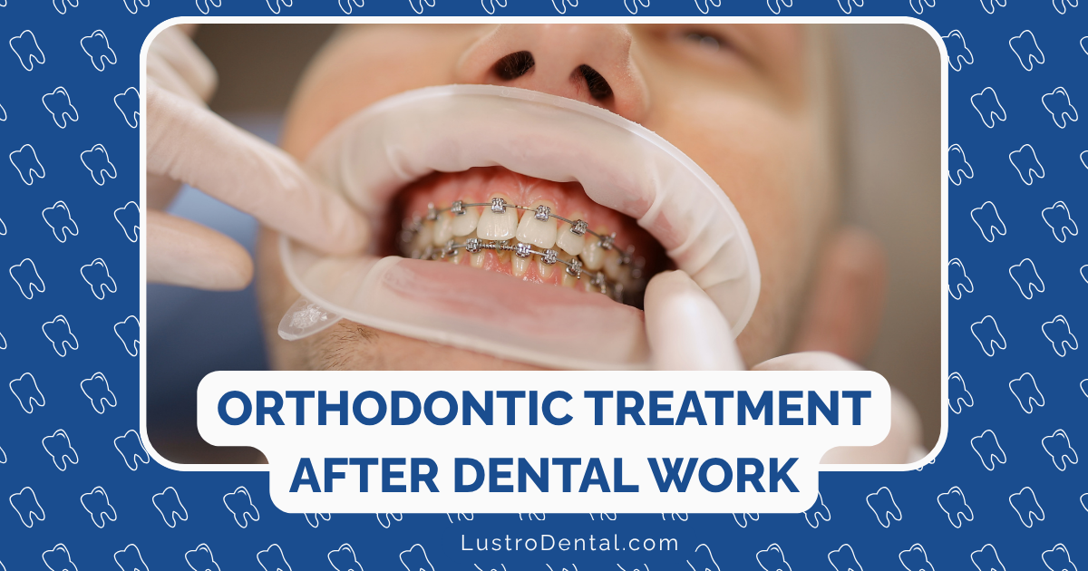 after orthodontic treatment