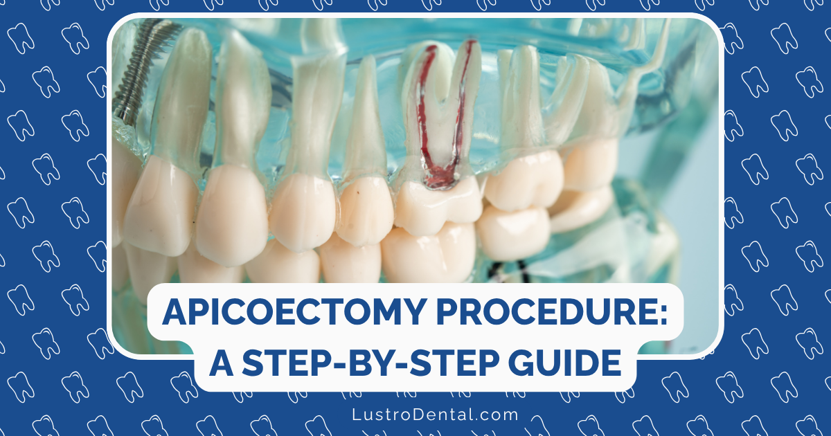 apicoectomy procedure
