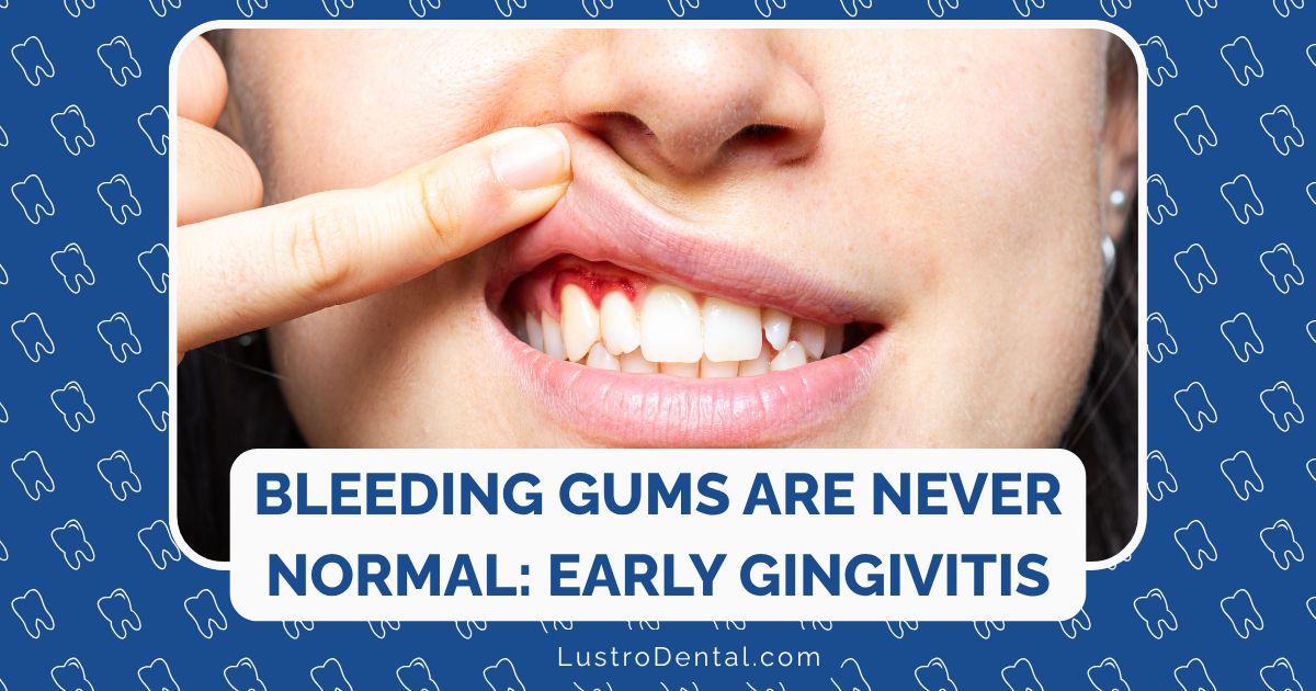 bleeding gums