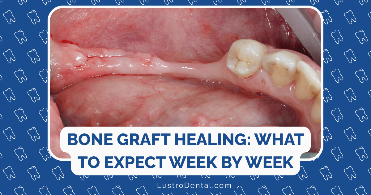 bone graft healing