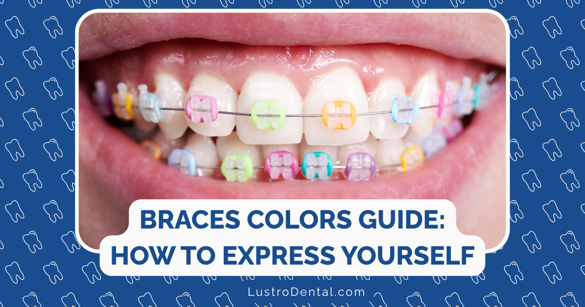 braces colors
