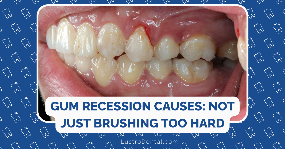 causes of gum recession