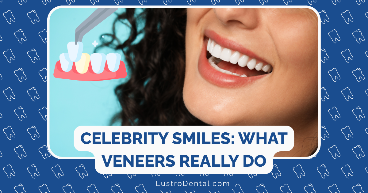 celebrity smiles