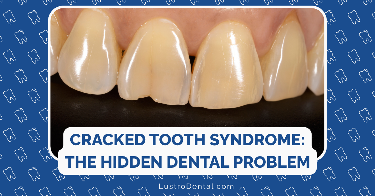 cracked tooth syndrome