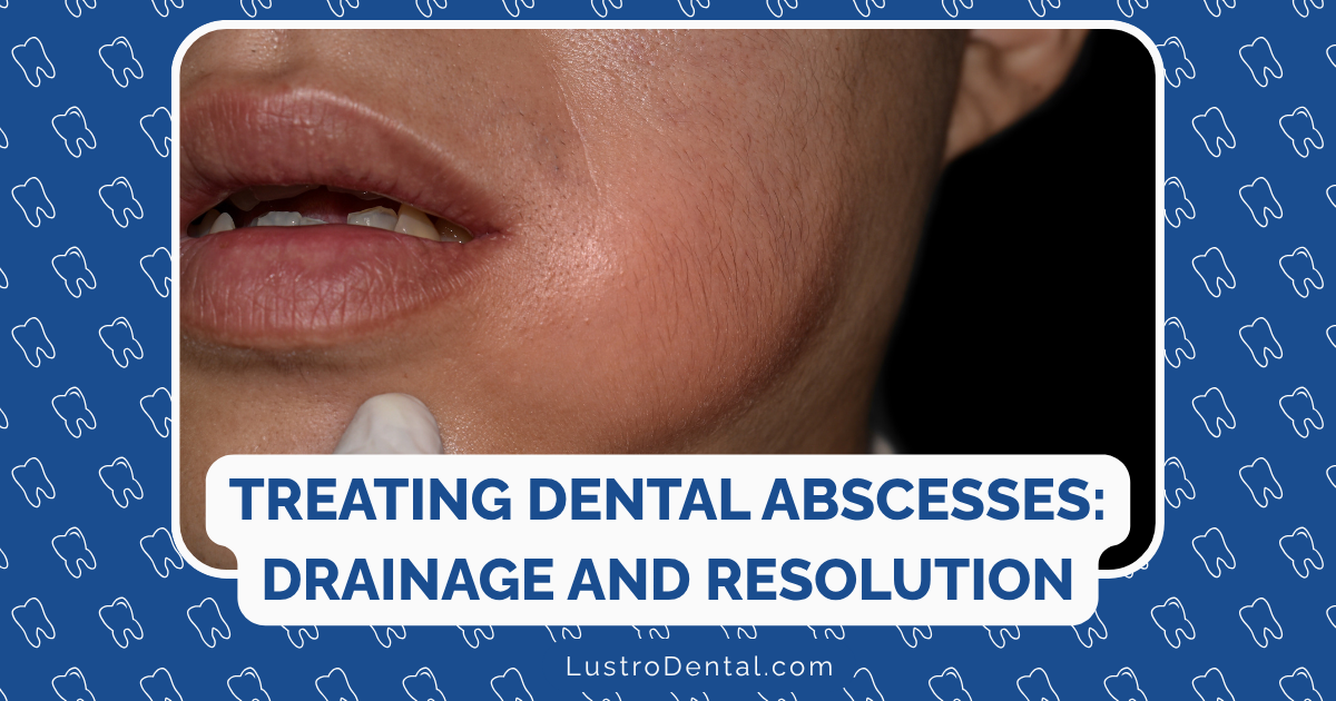 dental abscess drained