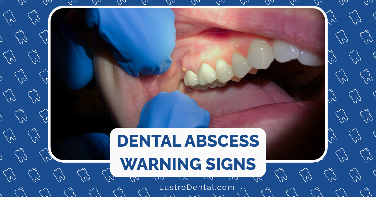 dental abscess