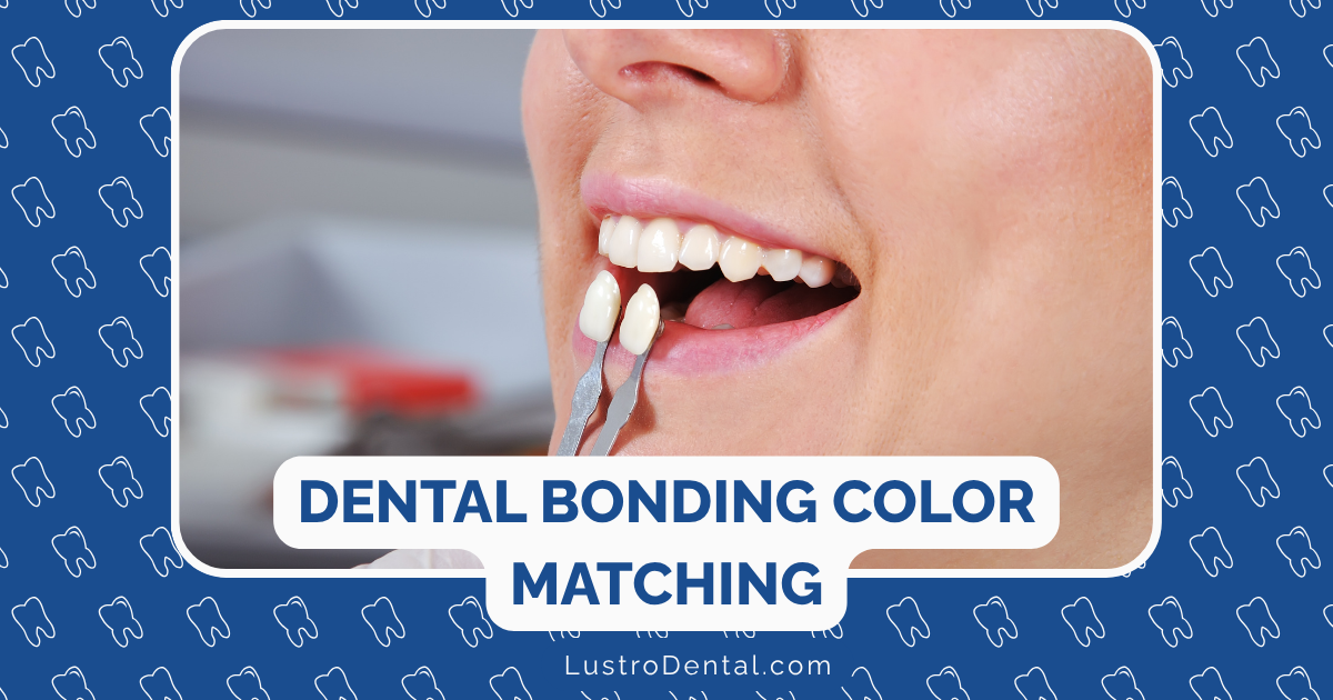 dental bonding color matching