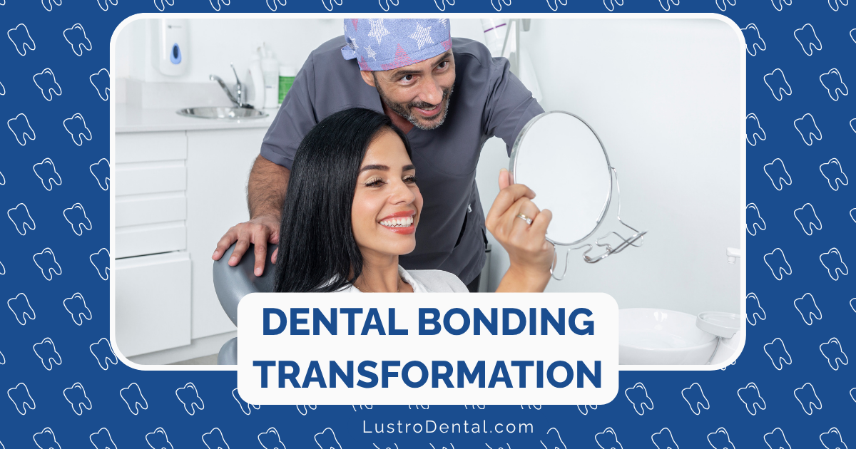 dental bonding transformation
