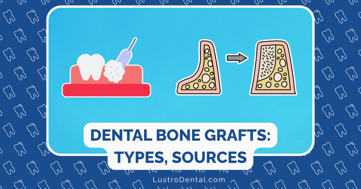 dental bone grafts