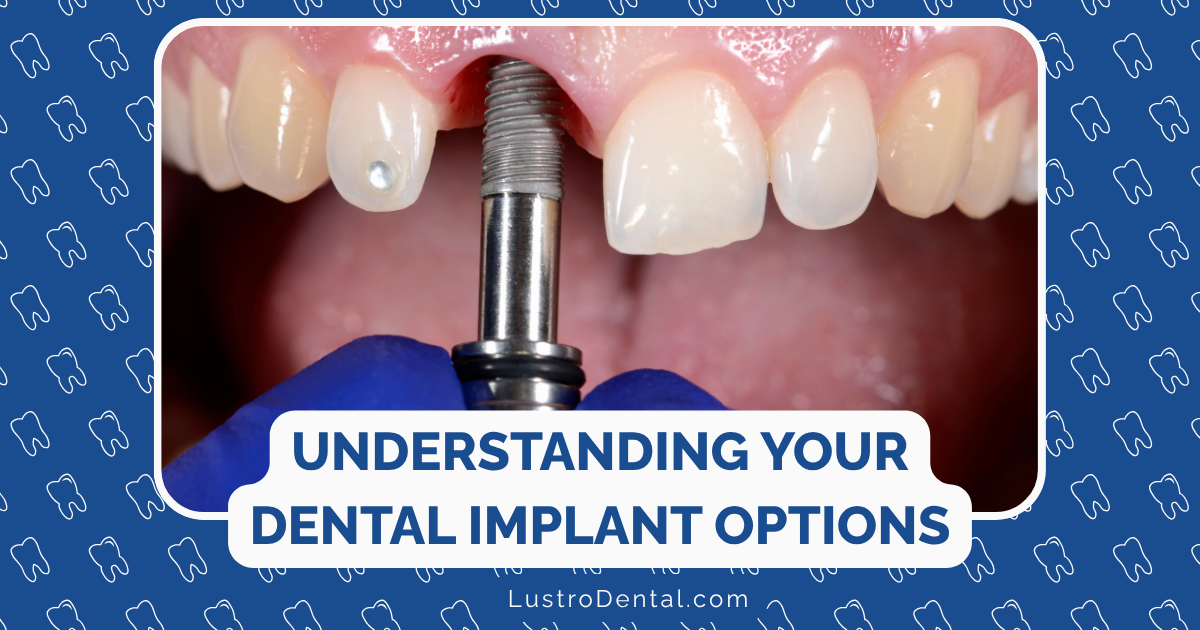 dental implant options