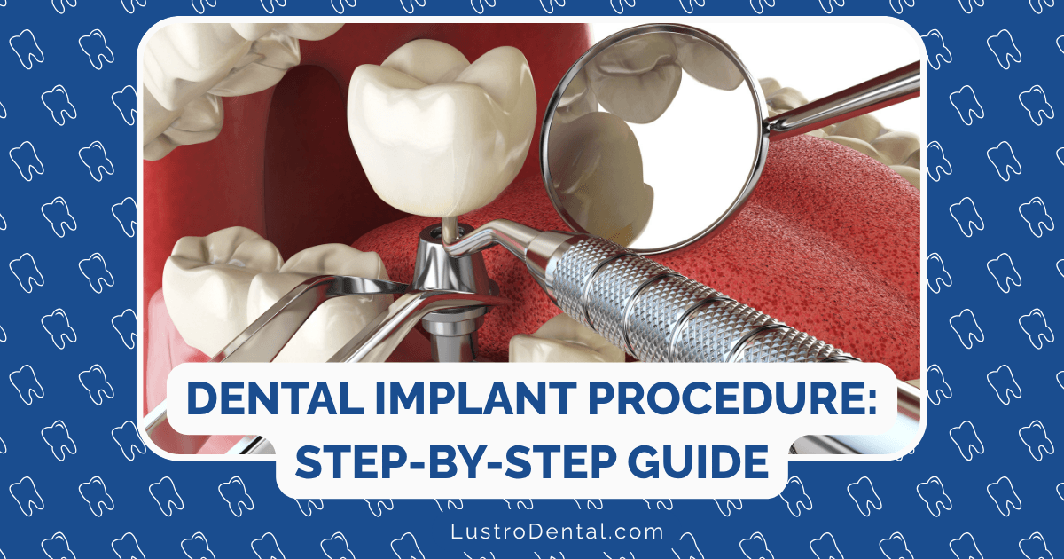 dental implant procedure