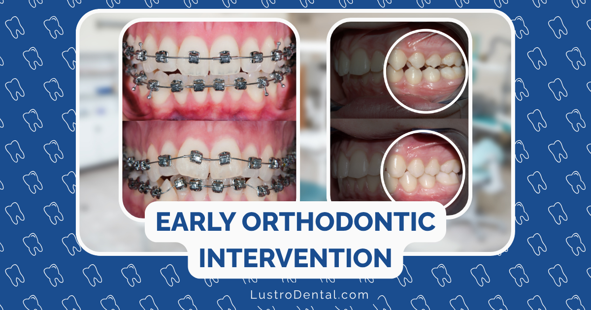 early orthodontic intervention