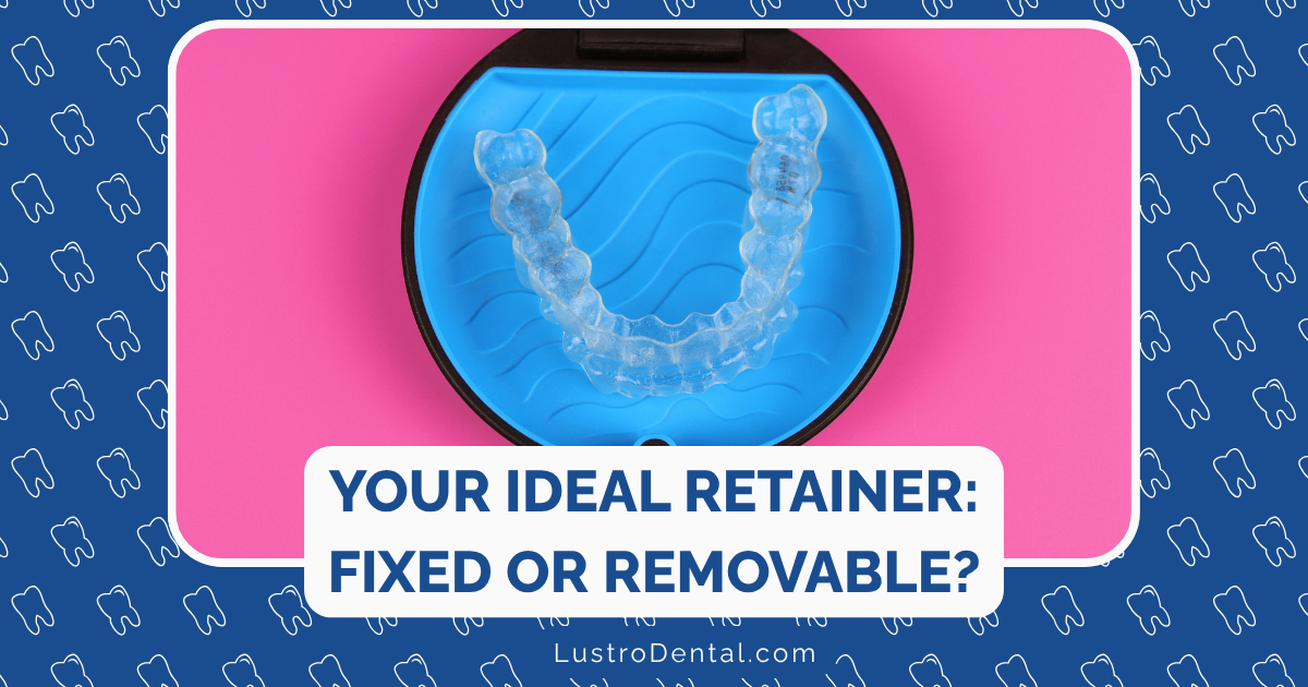 fixed and removable retainers
