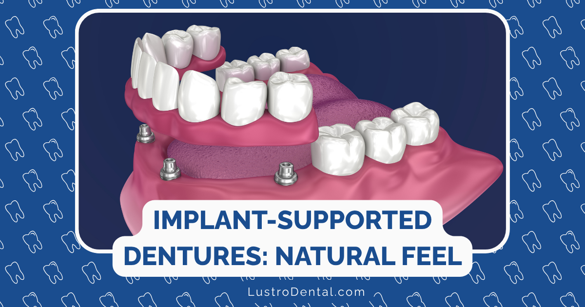 implant-supported dentures