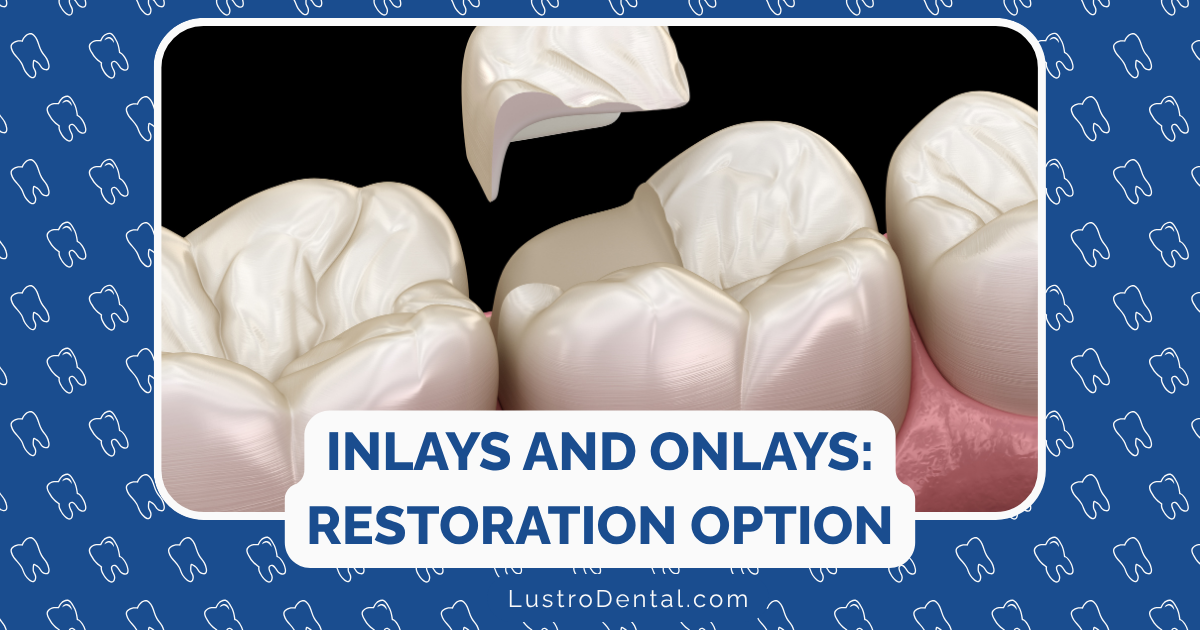 inlays and onlays