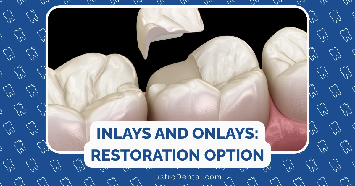 inlays and onlays