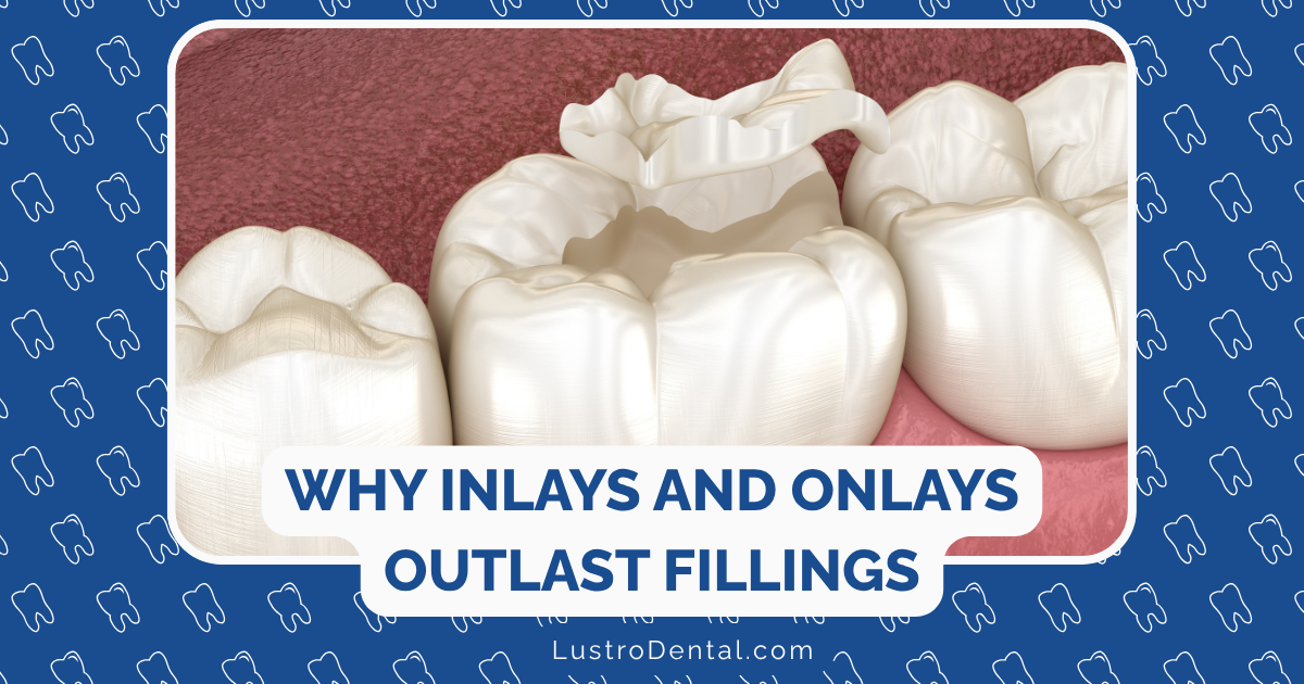 longevity of inlays and onlays