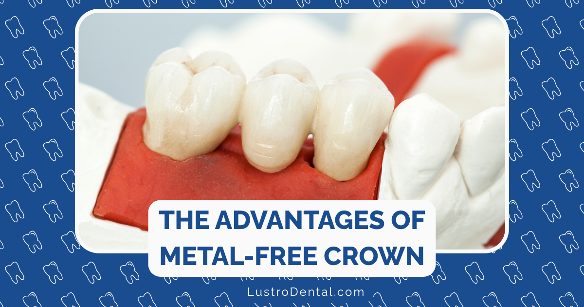 metal-free crowns