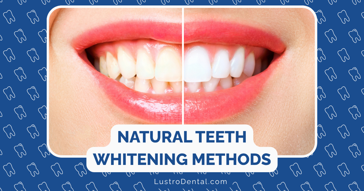 natural teeth whitening