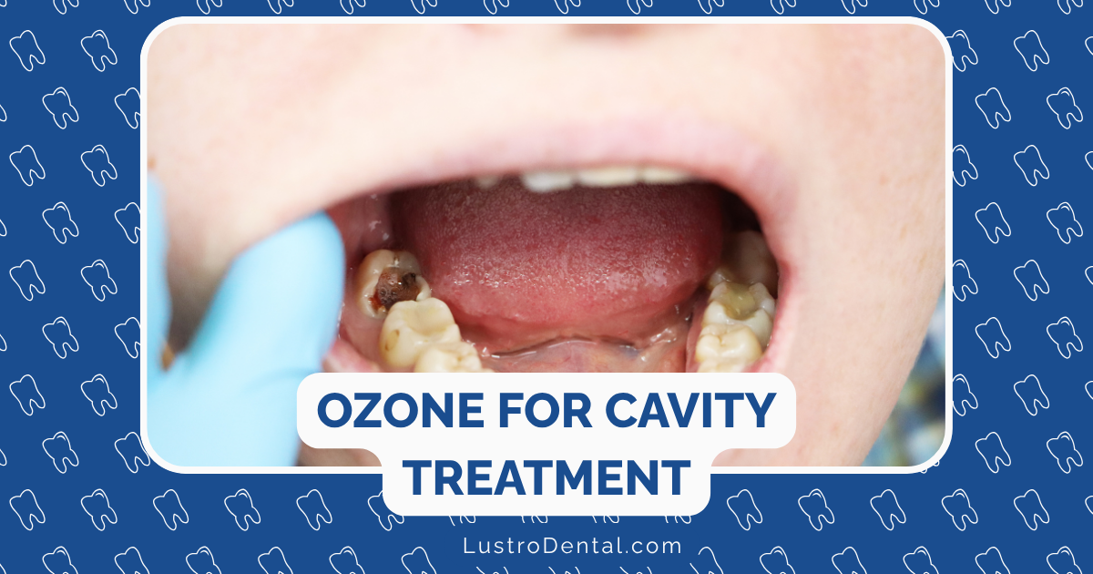 ozone for cavity treatment
