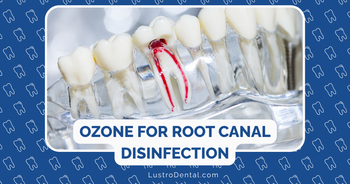 ozone for root canal