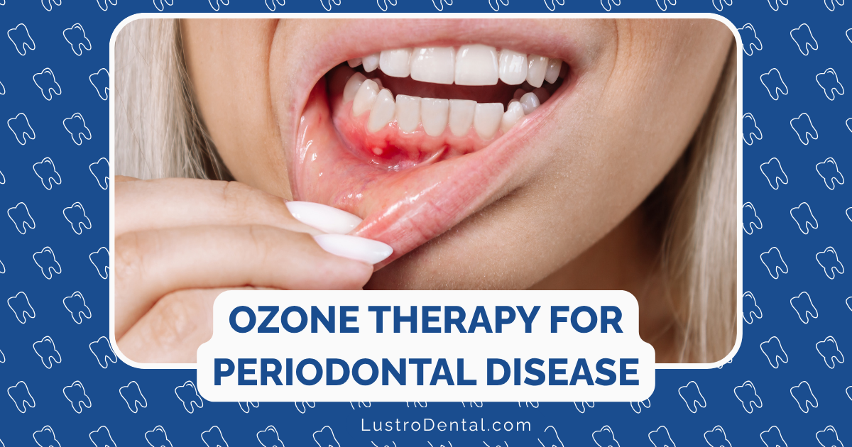 ozone therapy for periodontal disease