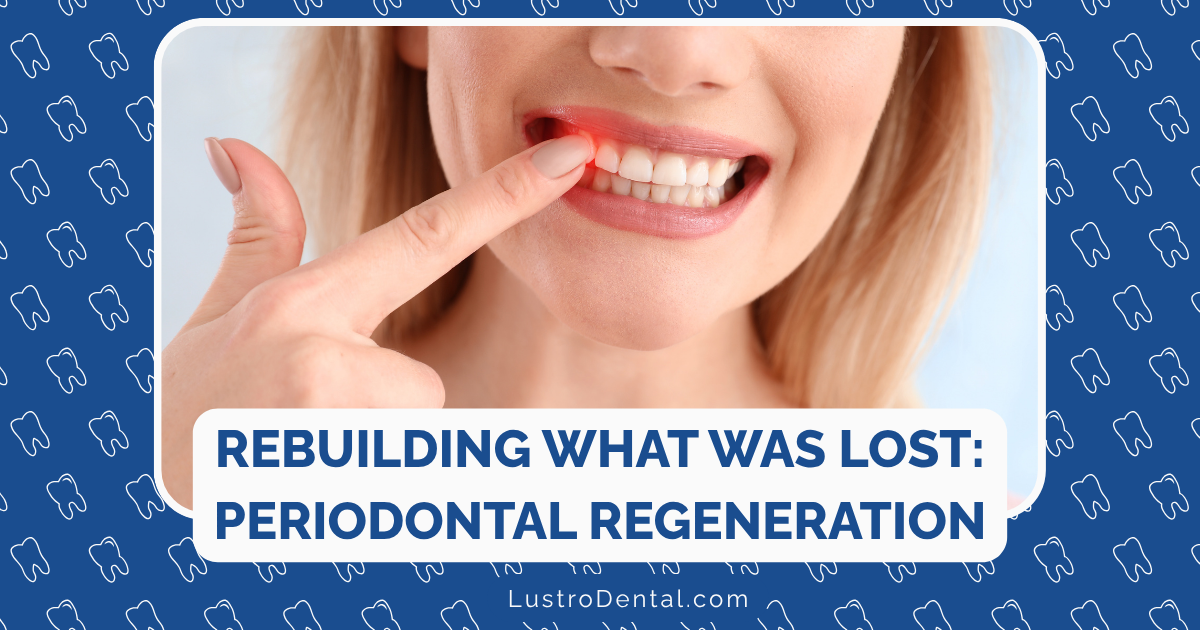 periodontal regeneration