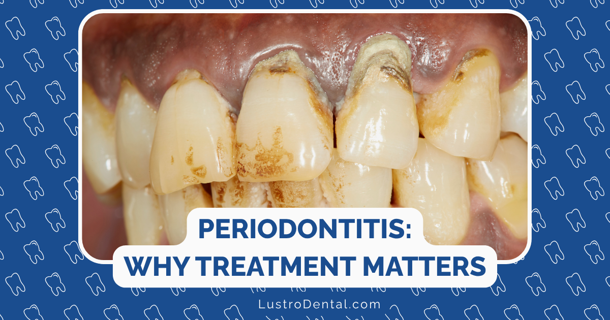 periodontitis and systemic diseases