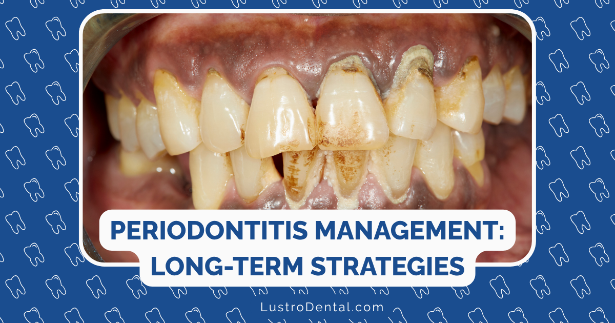 periodontitis management