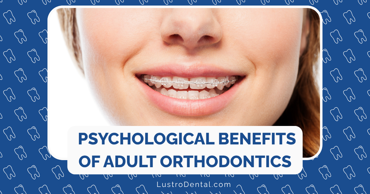 psychological benefits of adult orthodontic treatment