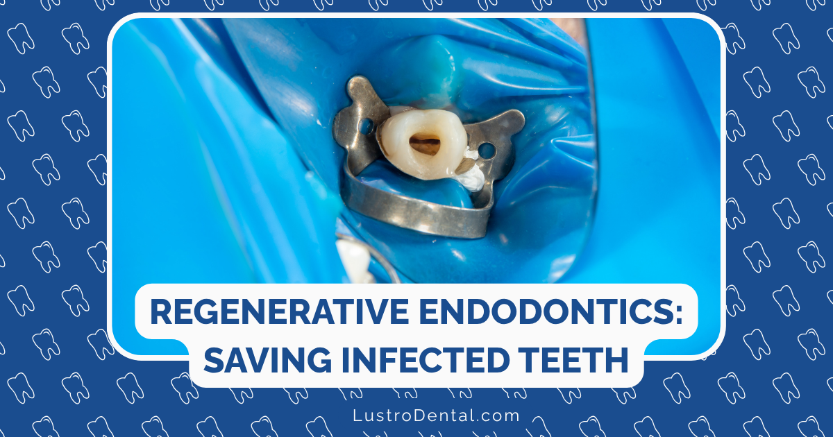 regenerative endodontics