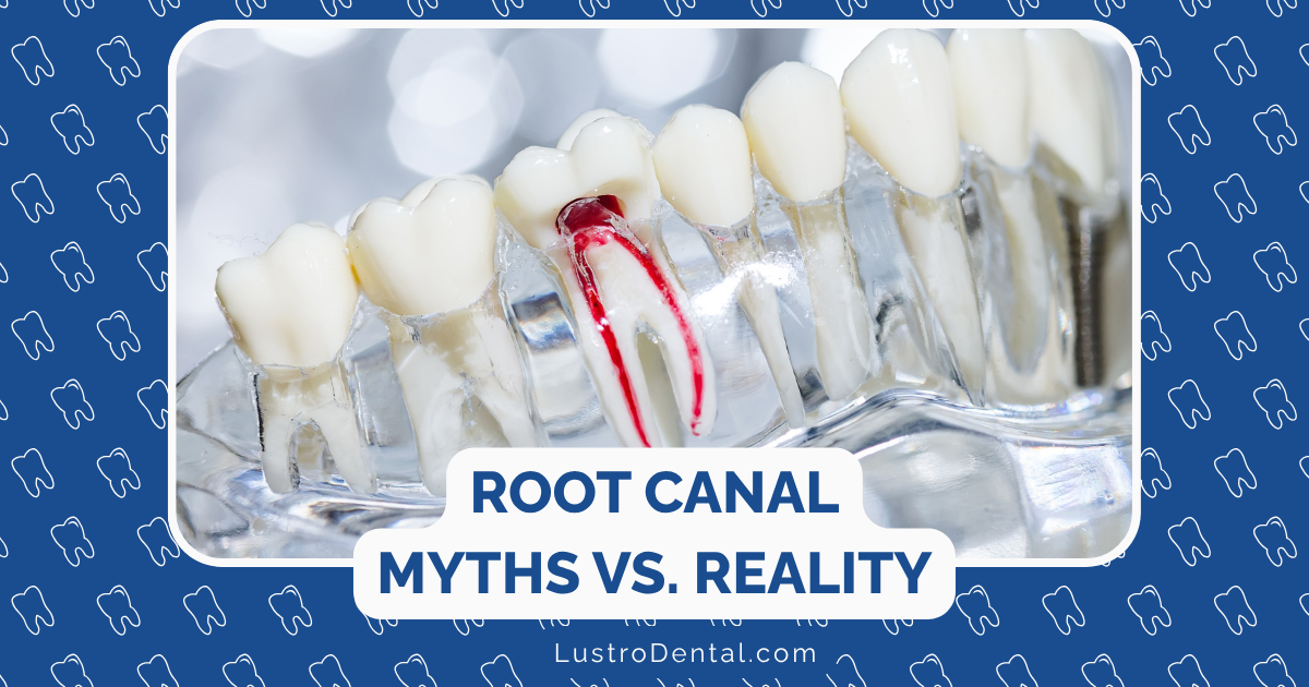 root canal myths