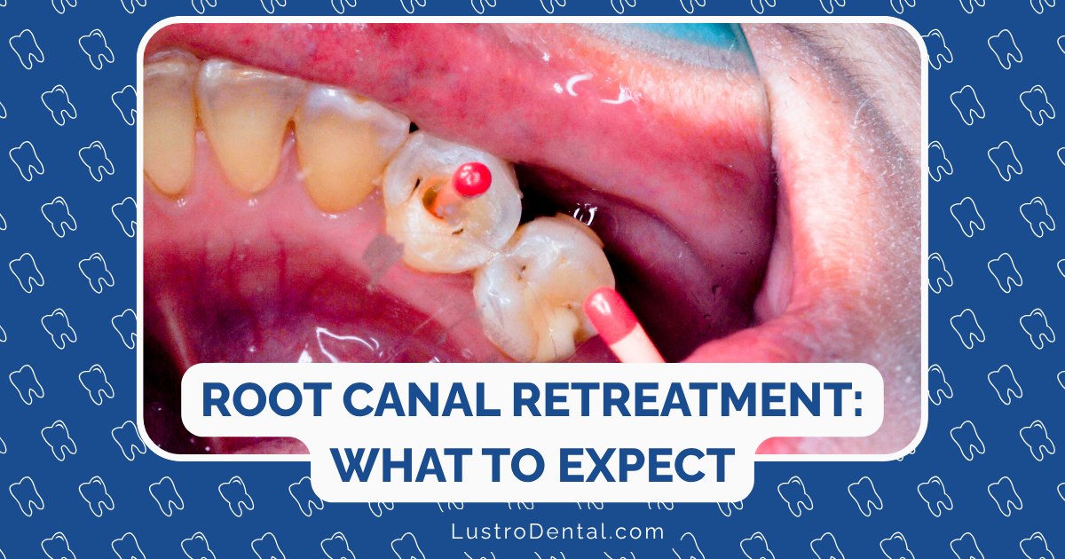 root canal retreatment