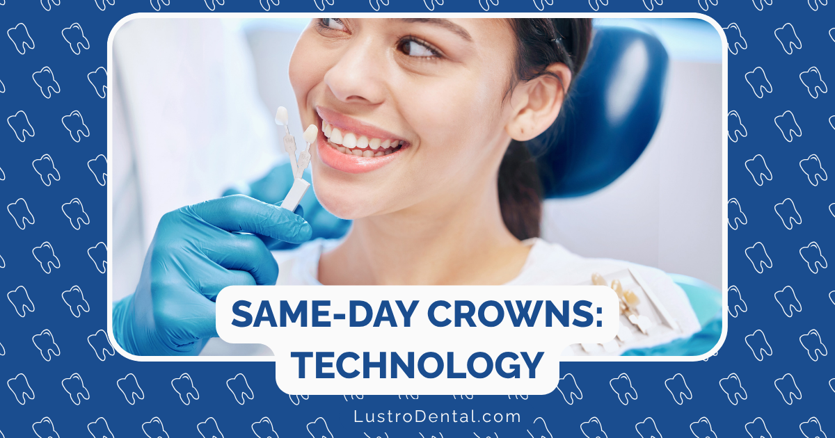 same-day crowns