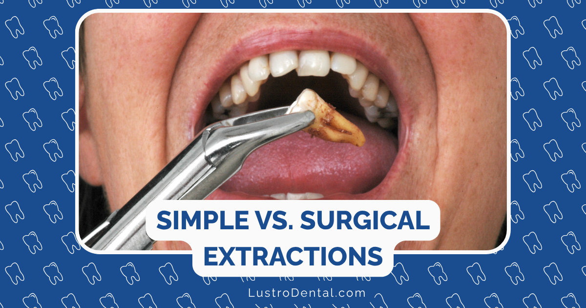 simple and surgical extractions