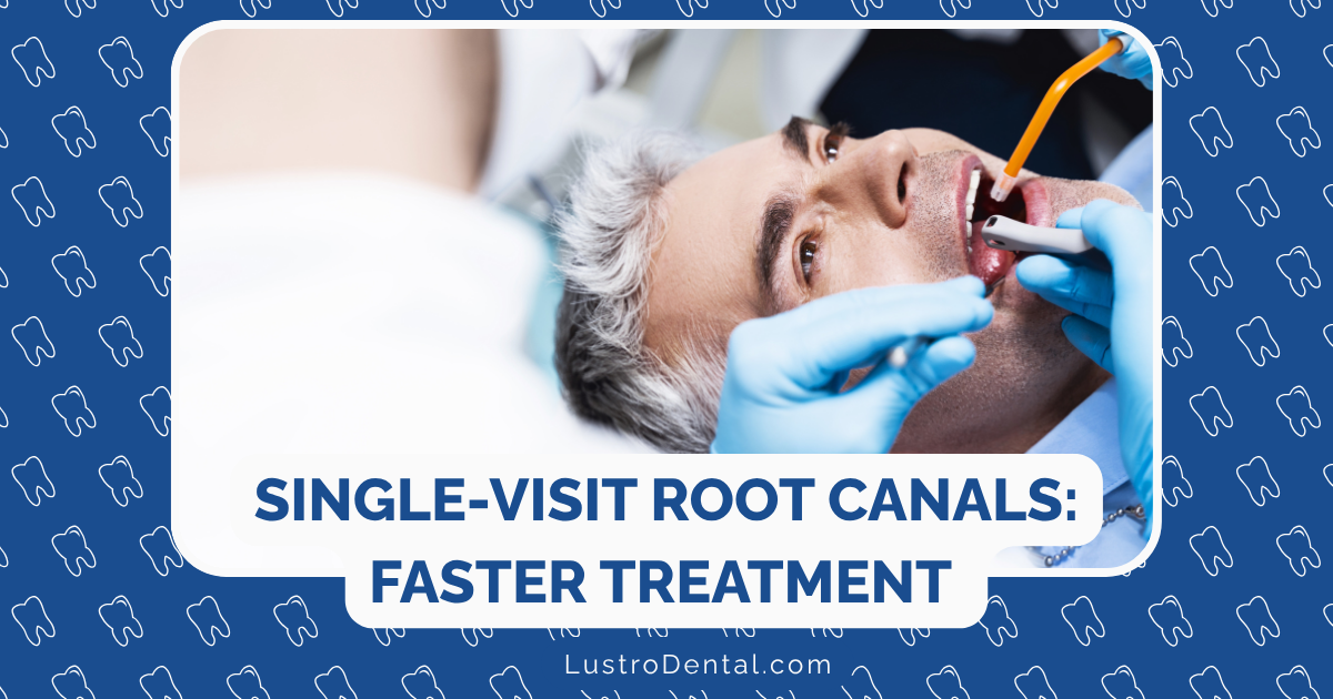 single-visit root canals