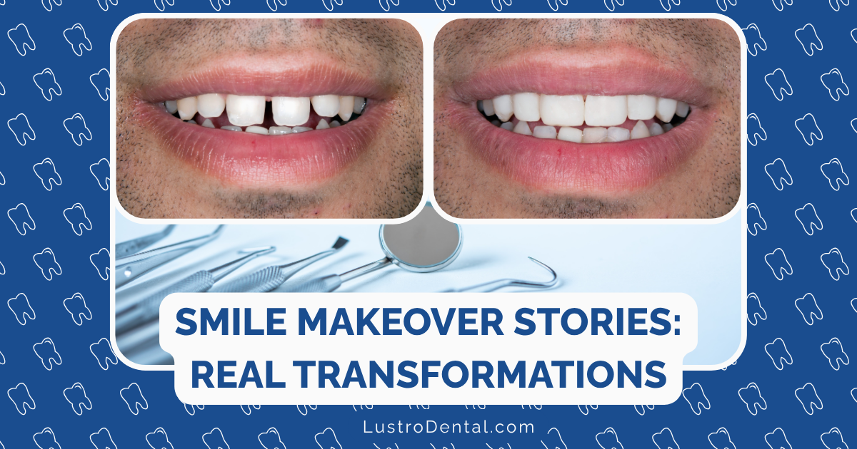 smile makeover