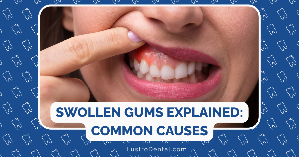swollen gums