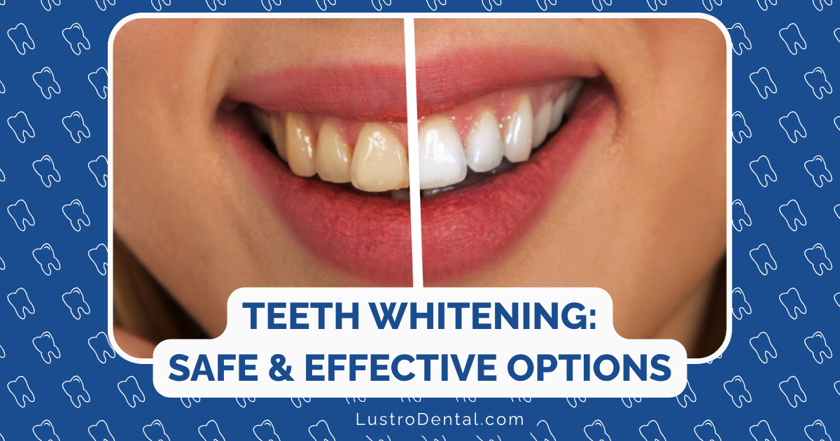 teeth whitening