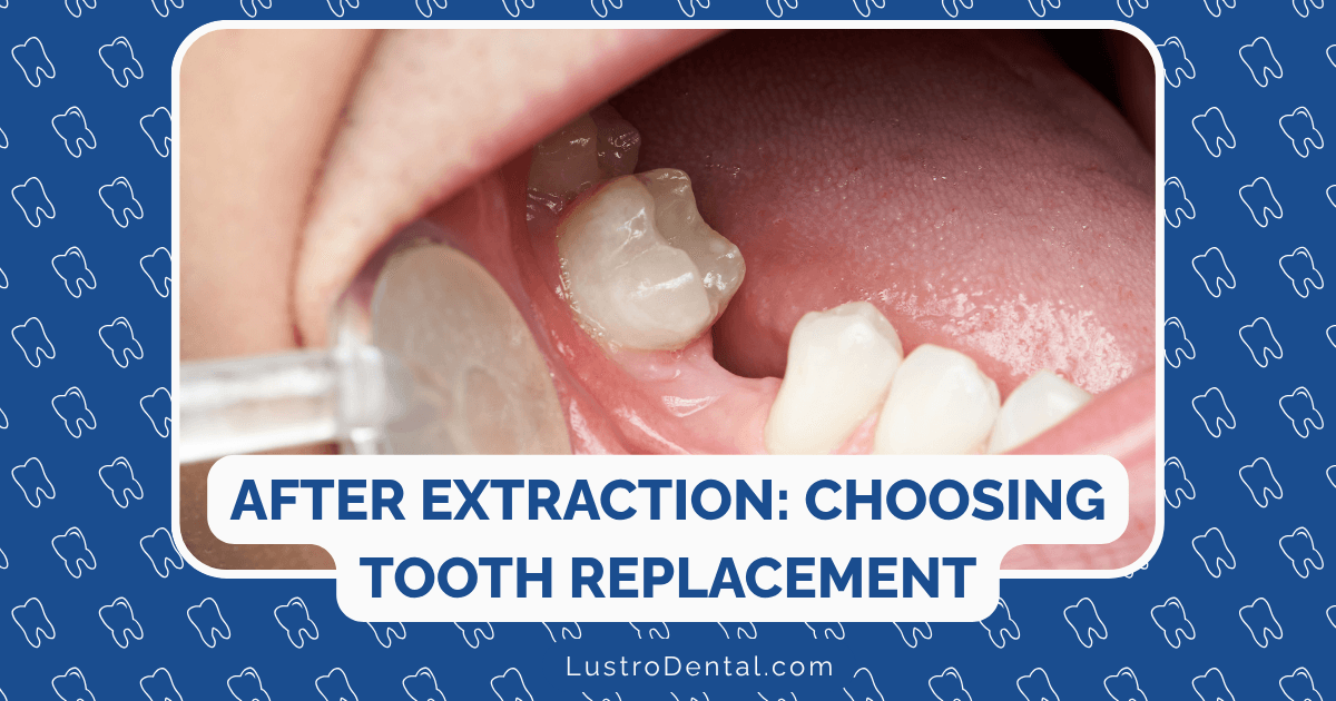 tooth replacement options
