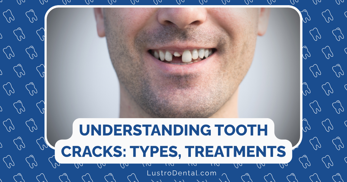 types of tooth cracks