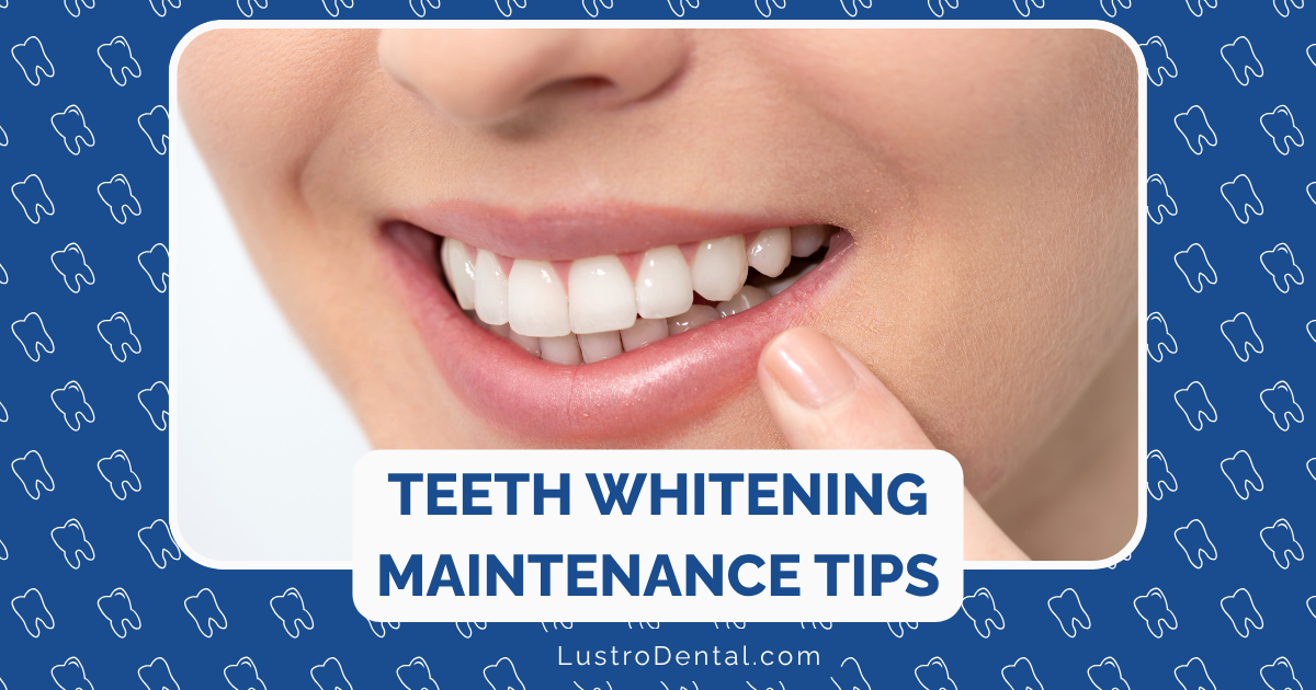 whitening maintenance