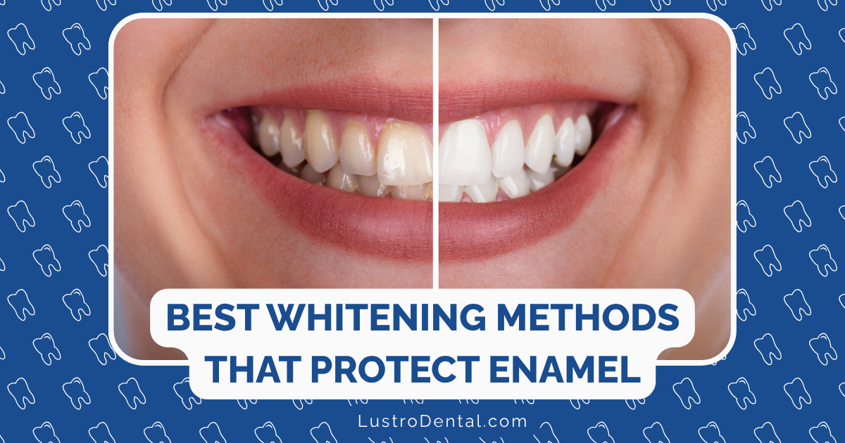 whitening methods