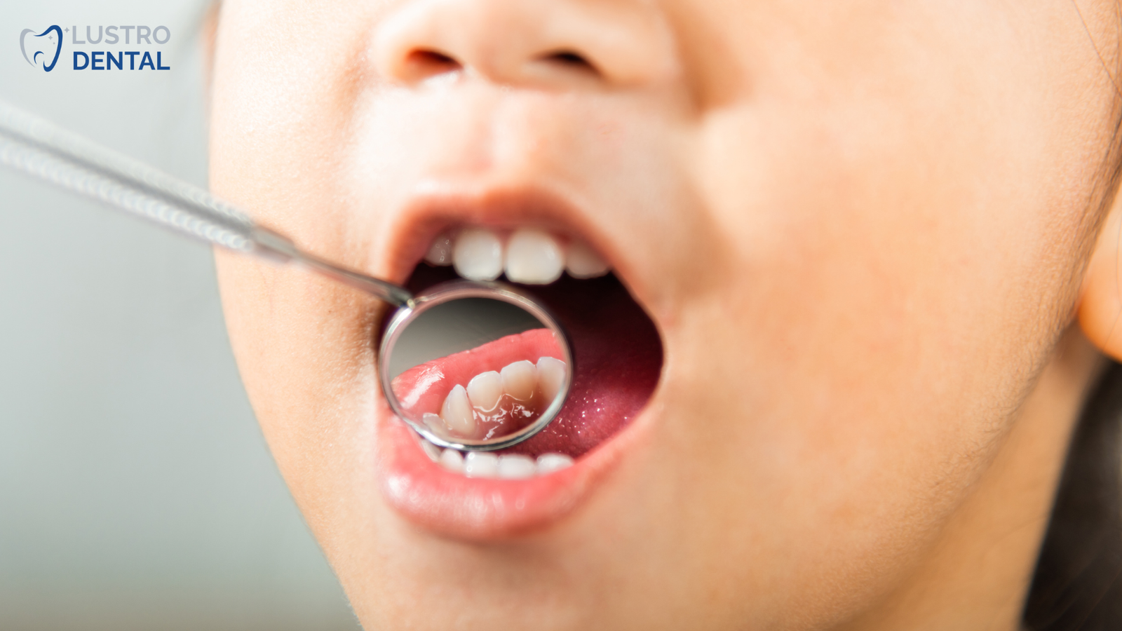A dentist gently examines a baby's teeth while the parent maintains eye contact and offers reassurance.